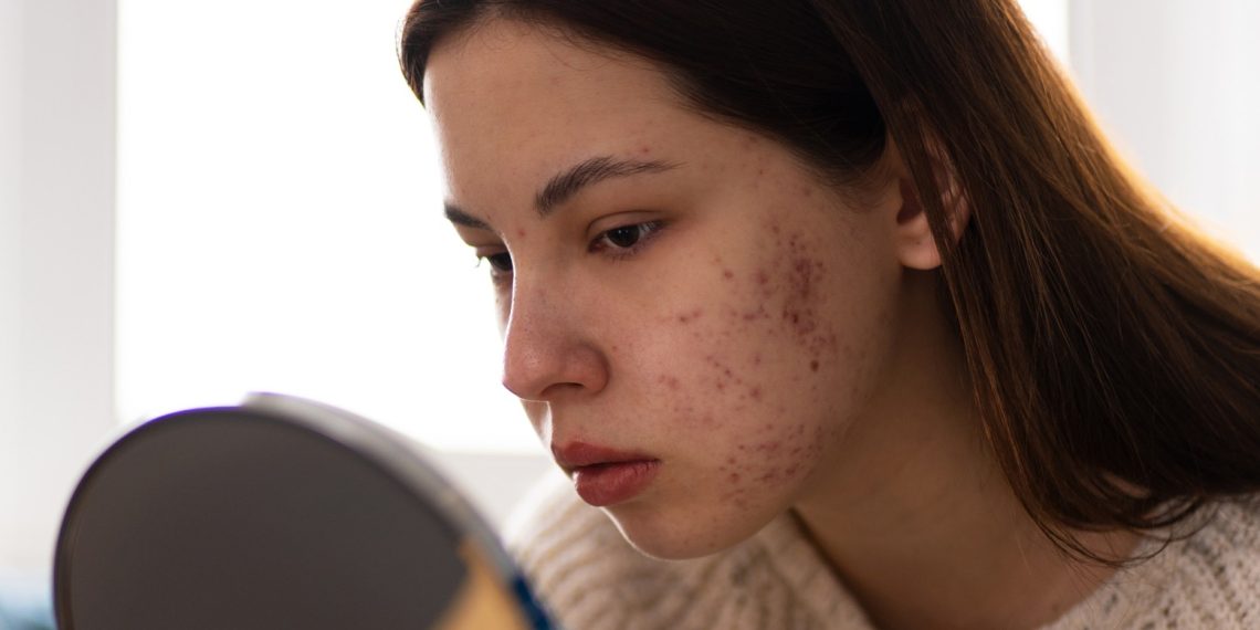 O que fazer e como detectar que a saúde da pele não está boa
