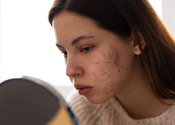O que fazer e como detectar que a saúde da pele não está boa