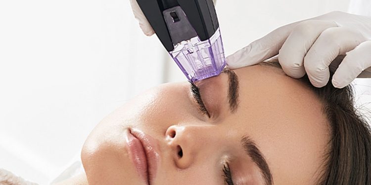 tratamento estético com o equipamento Morpheus8