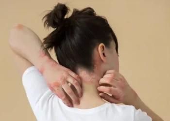 Coceira nas costas. Foto: Freepik