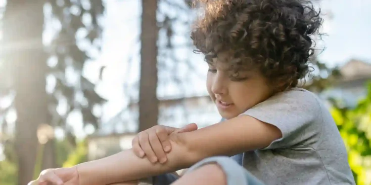 Criança com dermatite